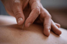 Image for Acupuncture Initial Treatment (90 Minutes)