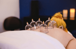 Image for 30 Minute Cupping Session